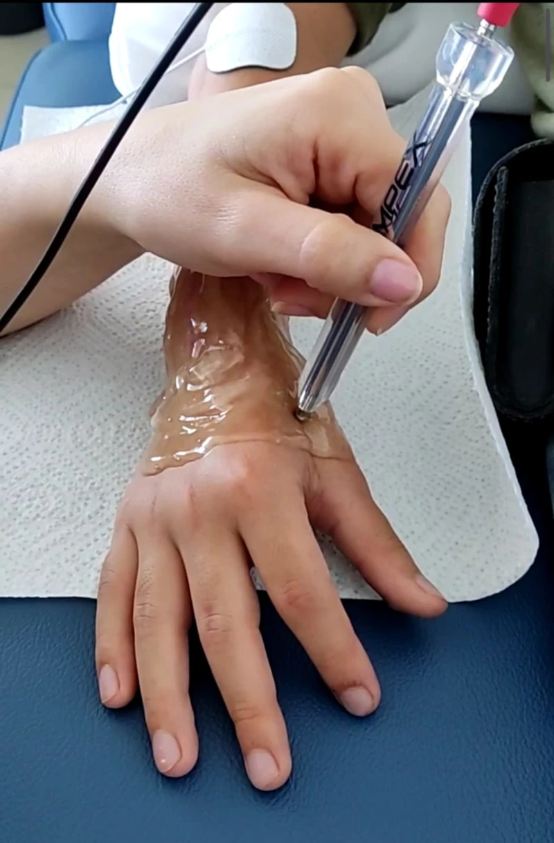 Tratamiento con electroterapia